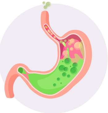 Diagnóstico de la Enfermedad por reflujo gastroesofágico