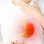 Manejo del ERGE que no responde al tratamiento médico