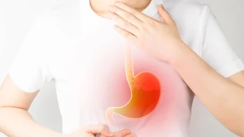 Manejo del ERGE que no responde al tratamiento médico