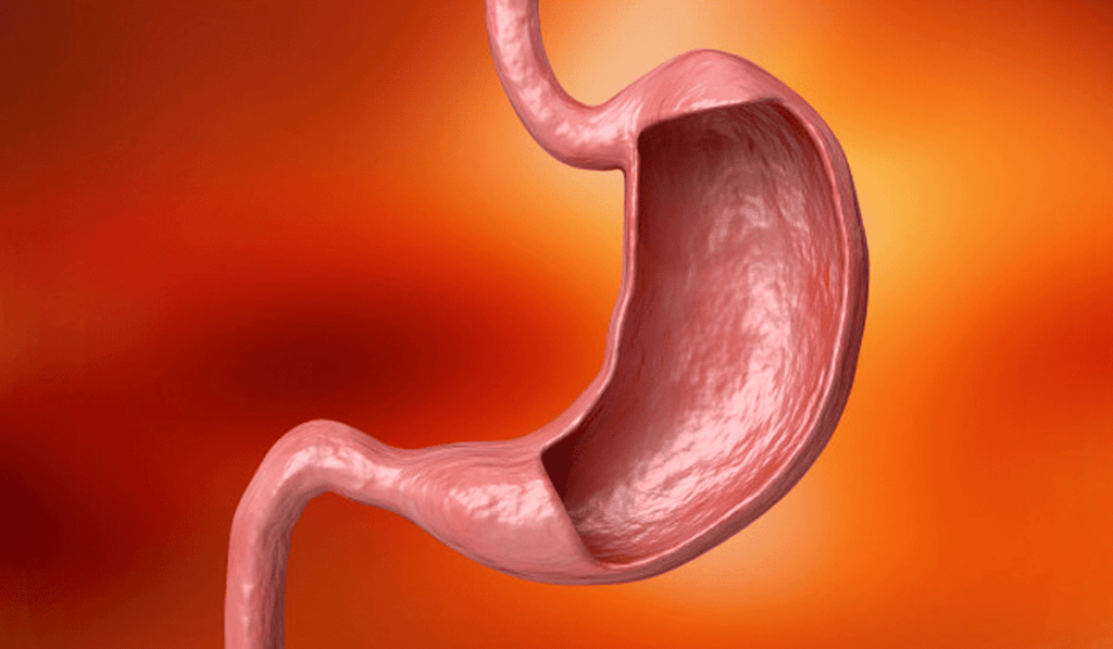 ¿Qué es la Gastritis asociada a anemia perniciosa?