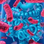 Crecimiento excesivo de bacterias intestinales