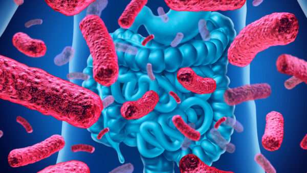 Crecimiento excesivo de bacterias intestinales