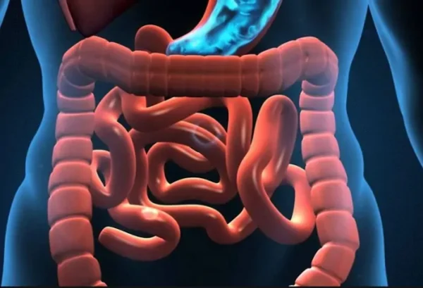 Síndrome del intestino corto