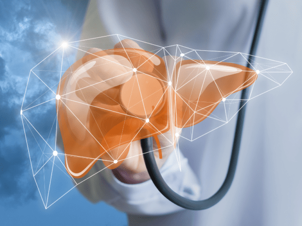 Diagnóstico de cirrosis hepática