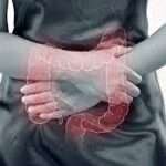 Opciones farmacológicas para el tratamiento de la enfermedad intestinal inflamatoria