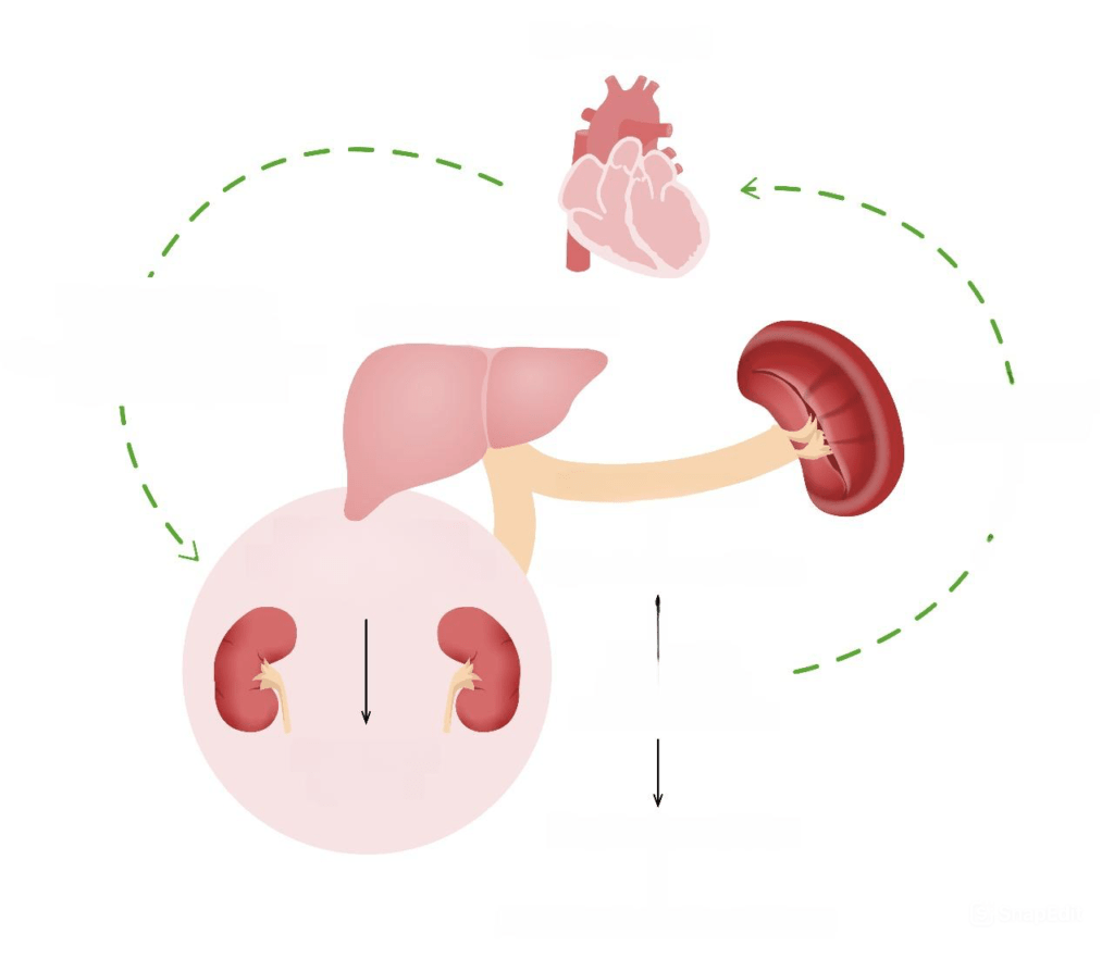 Tratamiento del síndrome hepatorrenal
