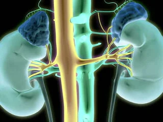 Aldosteronismo primario