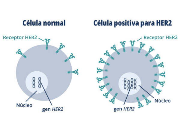 Terapia dirigida a HER2 en el cáncer de mama