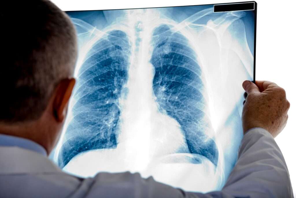 Fases del proceso de diagnóstico