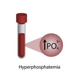 Hiperfosfatemia