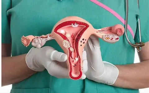 Medidas para prevenir el cáncer cervicouterino