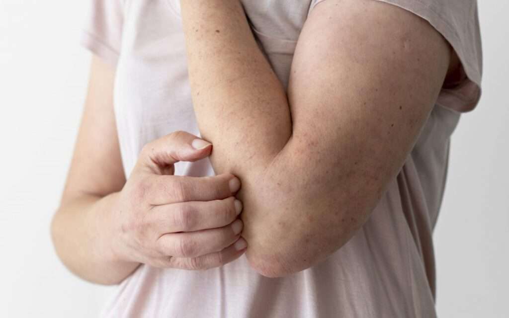 Complicaciones neurológicas de pacientes con insuficiencia renal crónica