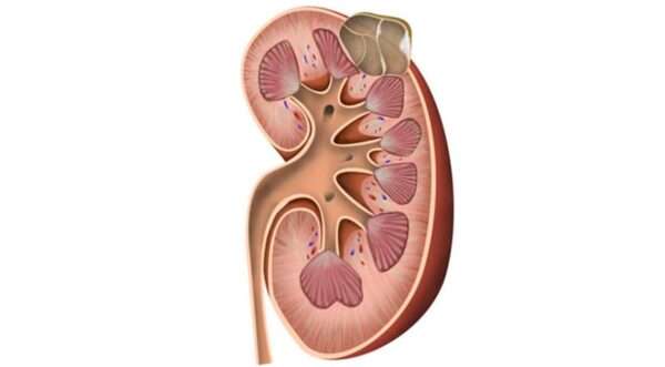 Quistes renales simples