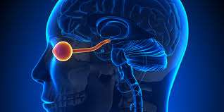 ¿Qué es la Neuromielitis óptica?