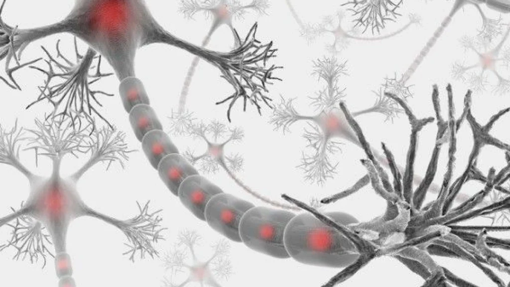 Polineuropatía inflamatoria crónica