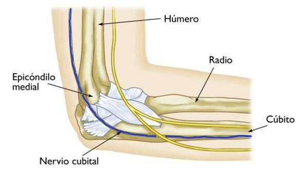 Lesiones del nervio cubital