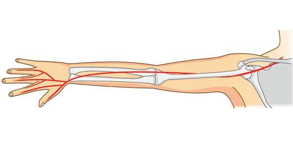 Lesiones del nervio radial
