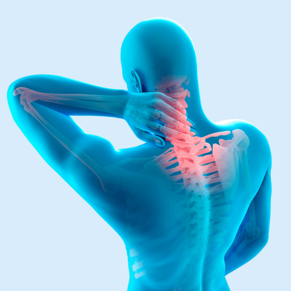 Dolor de cuello discogénico