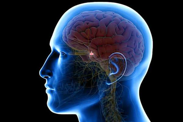 Hipopituitarismo anterior