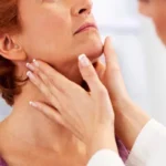 Tratamiento del hipertiroidismo