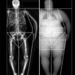 Enfermedad ósea metabólica