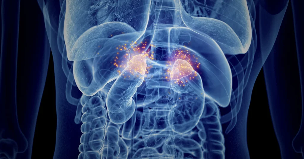 Insuficiencia suprarrenal primaria (Enfermedad de Addison)