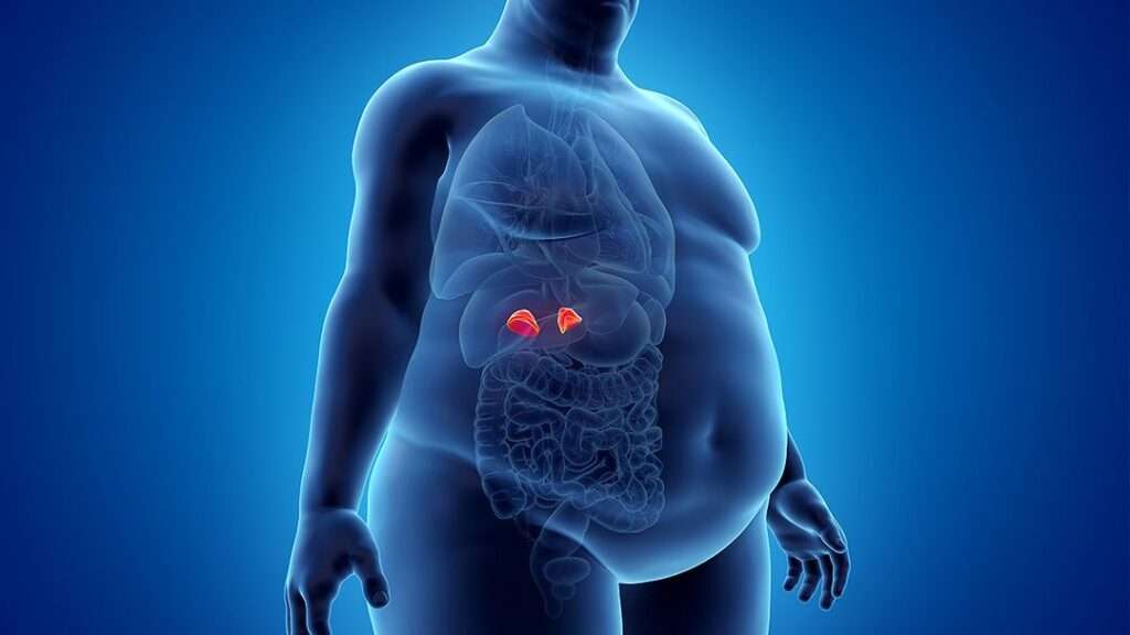 Síndrome de Cushing (Hipercortisolismo)