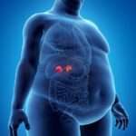 Síndrome de Cushing (Hipercortisolismo)