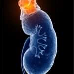 Masas suprarrenales descubiertas incidentalmente