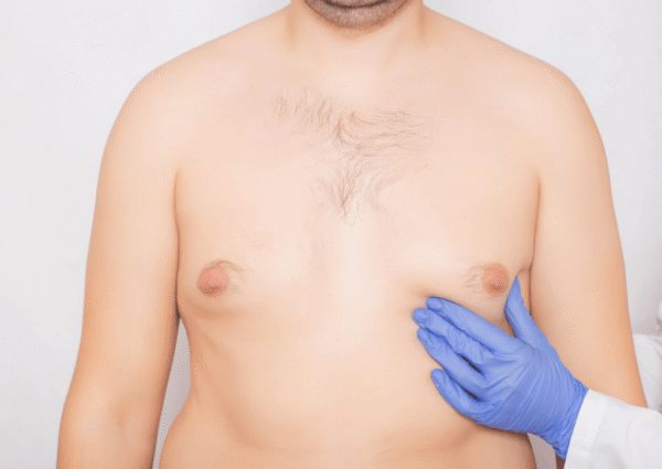 Hipogonadismo masculino