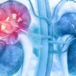 Complicaciones renales crónicas de la diabetes mellitus