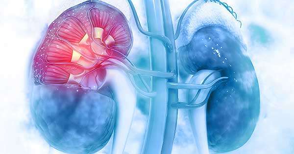 Complicaciones renales crónicas de la diabetes mellitus