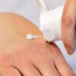 Complicaciones de la piel y las membranas mucosas en pacientes diabéticos