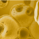 Trastornos lipídicos