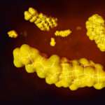 Las fracciones lipídicas y su relación con el riesgo de enfermedad coronaria son un tema clave en la investigación cardiovascular