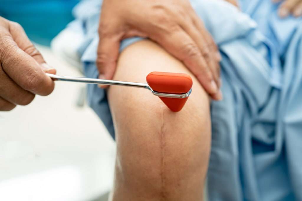 Deficiencia de vitamina E