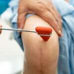 Deficiencia de vitamina E