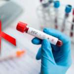 Epidemiología de la infección por VIH y el SIDA