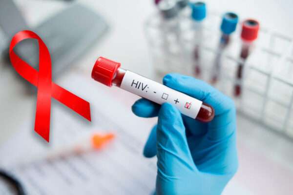Epidemiología de la infección por VIH y el SIDA