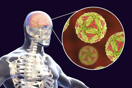 Encefalitis Japonesa