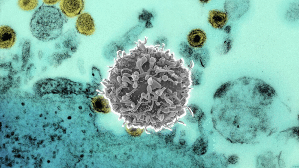 Virus linfotrópico de células T humanas