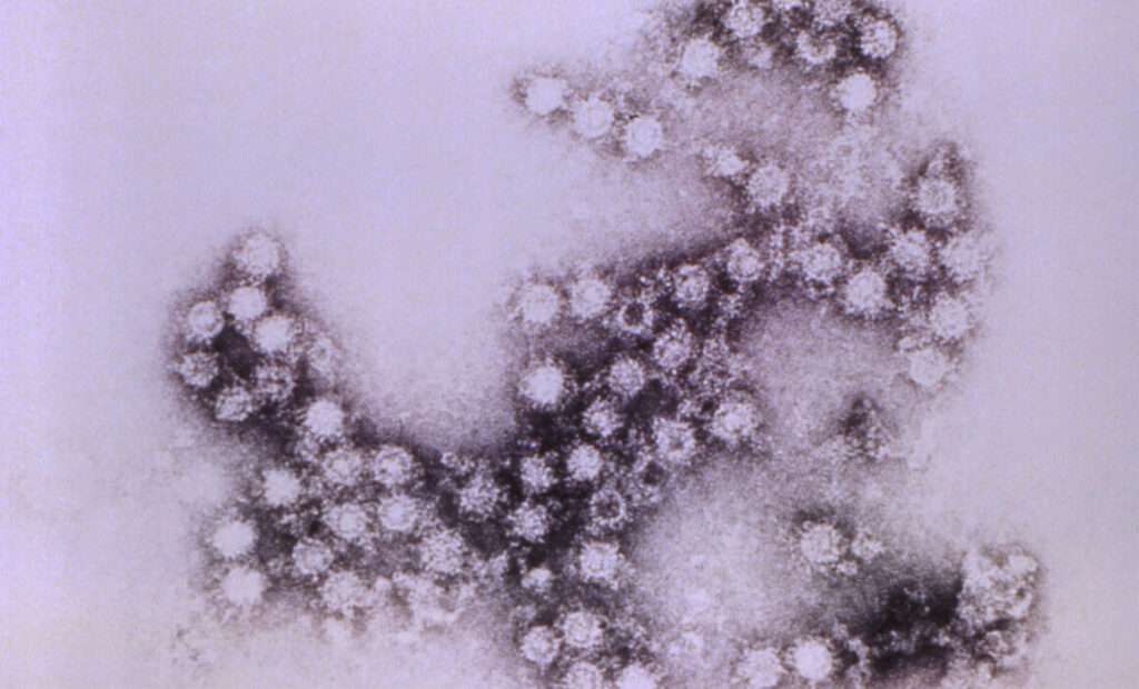 Las infecciones por echovirus