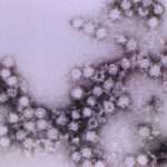 Las infecciones por echovirus