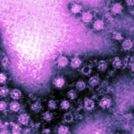 Enterovirus 68, 70, 71 y agentes relacionados.