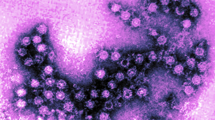Enterovirus 68, 70, 71 y agentes relacionados.