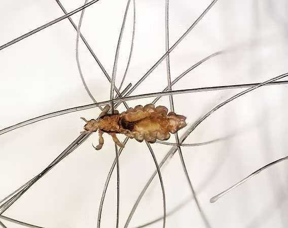 Tifus epidémico (transmitido por piojos)