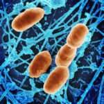 El tifus endémico (murino)