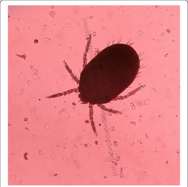 La fiebre de Tsutsugamushi (Fiebre de Scrub Typhus)