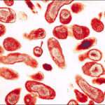 Fiebre Q (Infección por Coxiella burnetii)