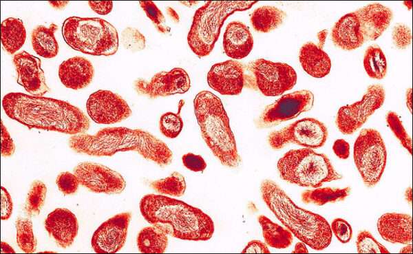 Fiebre Q (Infección por Coxiella burnetii)
